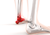 Ankle hurts ｜ Red ｜ Sprain / Bone ｜ Medical facility / Interview ｜ Human body / Explanation ――Free illustration material ――Medical ｜ Nursing ｜ Hospital ｜ Person