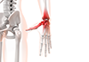 Wrist ｜ Joint ｜ Inflammation / Red ｜ X-ray / Medical examination ｜ Mobile bed / Emergency ――Free illustration material ――Medical ｜ Nursing ｜ Hospital ｜ Person