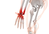 Sprain | Wrist | Joint / Treatment | Human Dock / MRI | Nurse / Nurse --Free Illustration Material --Medical Care | Nursing Care | Hospital | Person