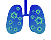 Lung ｜ Pathogen ｜ Disease onset ――Free illustration material ――Medical care ｜ Nursing care ｜ Hospital ｜ Person